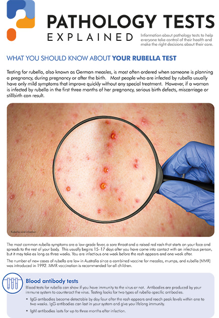 Rubella